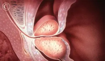 Médicos españoles localizan gen favorece resistencia cáncer de próstata