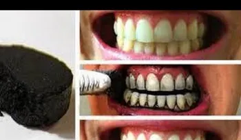 Los dentistas los ocultan a su conveniencia: elimina el sarro en 5 minutos (VIDEO)