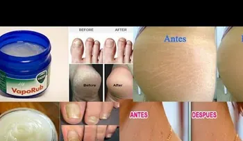 Nadie me lo dijo nunca: Los increíbles usos del VICKS VAPORUB 