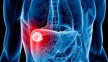 Desarrollan método para diagnosticar hígado graso 