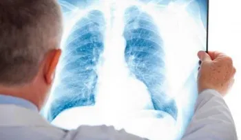 Seis recomendaciones para pacientes con hipertensión pulmonar en época de Covid-19