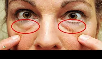 Cómo quitar las bolsas de los ojos en 20 minutos.