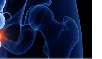Avance contra cáncer de próstata
