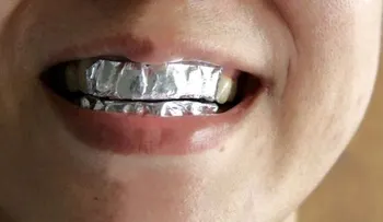 En 15 minutos cubrió sus dientes con papel de aluminio ¡El resultado fue sorprendente !