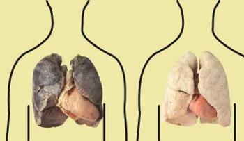 4 productos que purifican pulmones de un fumador. ¡No dejen de leerlo!