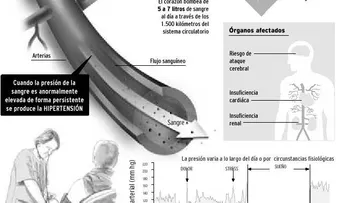 Recomendaciones para hacer ejercicio cuando tienes hipertensión