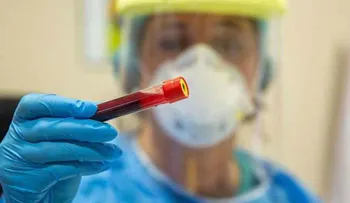 Científicos mexicanos desarrollan pruebas en sangre para cáncer de pulmón
