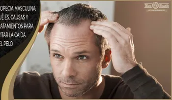 Tipos, Causas y Tratamientos para Evitar la Caída del Pelo