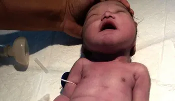 IMAGENES SENSIBLES: Una mujer dio a luz al quinto "bebé sirena" del mundo y lo perdió horas después 