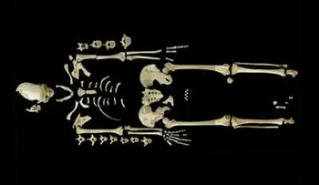 Primer caso de leucemia en un esqueleto de hace 7.000 años