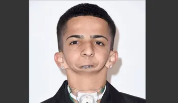 Joven sin mandíbula que escribe rap es nominado en premios para inspirar