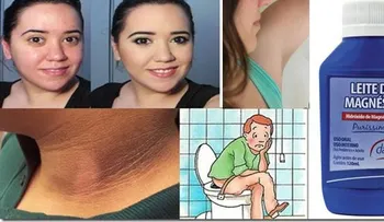 Los usos de la leche magnesia o "Magia Blanca" para la piel que necesitas conocer!
