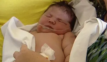 Nace bebe de 13 libras en España con parto natural