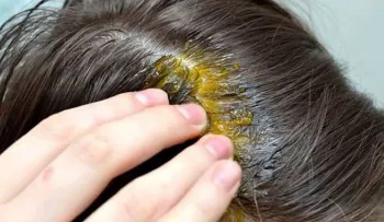 Si quieres saber como hacer crecer tu cabello, ceja y pestañas como una cosa loca, sigue leyendo