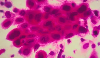 ¿Puedes vacunarte a ti mismo contra el cáncer?