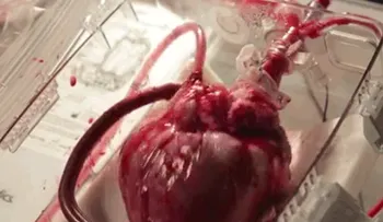 Descubren dispositivo revive corazones de personas que mueren