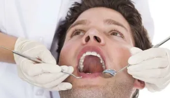 ¿Tener placa dental aumenta el riesgo de cáncer?