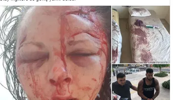 FUERTES IMAGENES: Un desconocido le da una golpiza a una turista porque se negó a tener sexo