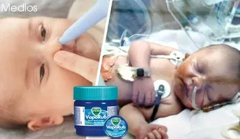 Nunca lo hagas: Madre untó VapoRub a su bebé y falleció después de unas horas 