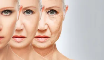 Lifting 3D facial, el nuevo concepto para rejuvenecer tu piel