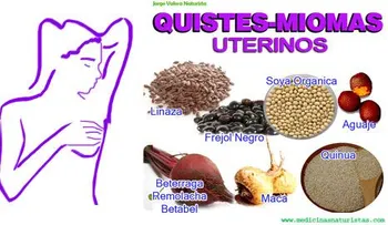 Remedios naturales para eliminar los miomas y quistes