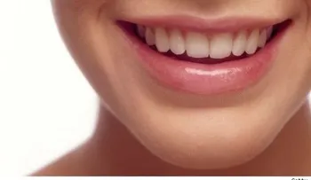 Periodontitis: El resultado de una mala higiene bucal