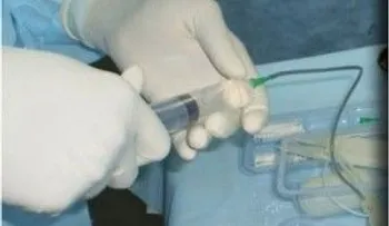 Dominicanos ya pueden hacerse implantes de pene