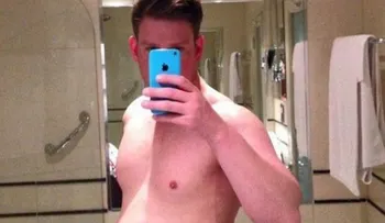 Este chico se convirtió en modelo después de una tragedia. ¡Solo mira cómo luce ahora!