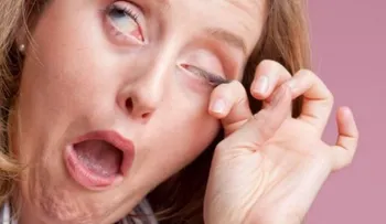 Si sufres de picazón frecuente en los ojos podrías tener alergia ocular