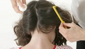 7 mitos falsos sobre los piojos que desconocías 