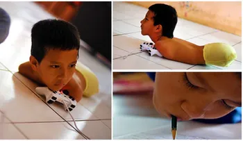 Este niño nació sin brazos ni piernas, pero tiene increíbles habilidades