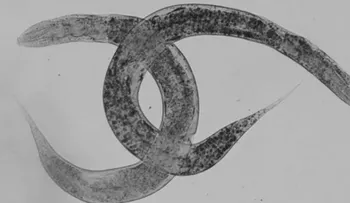 Un gusano facilita investigación de una enfermedad rara del sistema nervioso