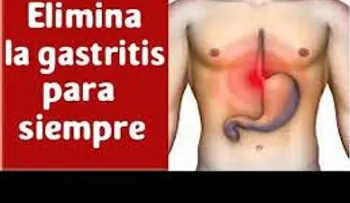Eficaz remedio para eliminar la acidez y la gastriti para siempre