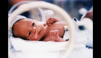 Virus respiratorio pone en peligro vida bebés prematuros