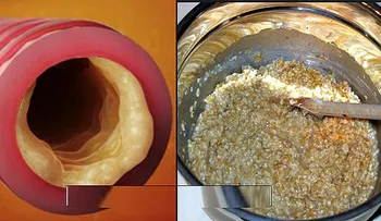 Para eliminar la muscosidad de los pulmones, prueba esto
