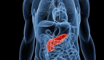¡Ojo! Los tumores neuroendocrinos no tienen síntomas específicos