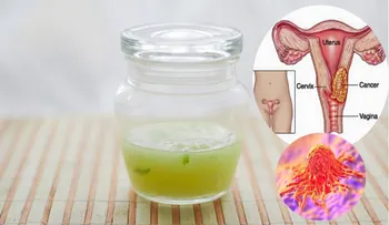 Cómo sanar cancer de utero con estos 3 ingredientes de gran alcance