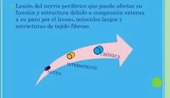 Síntomas de las neuropatías comprensivas