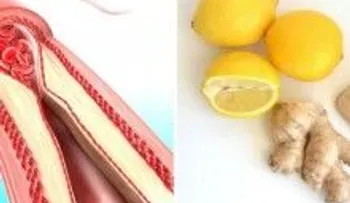 3 ingredientes para limpiar tus arterias