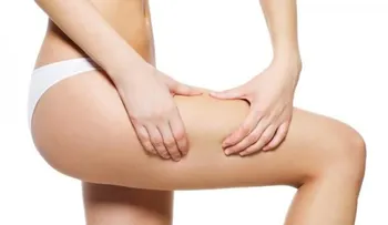 Cómo eliminar la celulitis de los muslos rápidamente