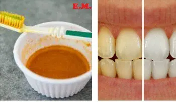 Cómo blanquear los dientes sin ir al dentista