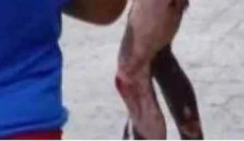 Queman vivo a un hombre en la Venezuela