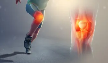 Imperdibles remedios para decirle adiós al dolor de rodilla