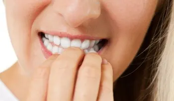 ¿Qué dice de tu personalidad que te muerdas las uñas?