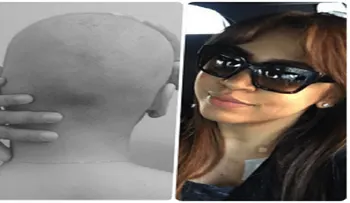 Merenguera Juliana se le cae todo el pelo por la quimioterapia. "Me siento muy bien"