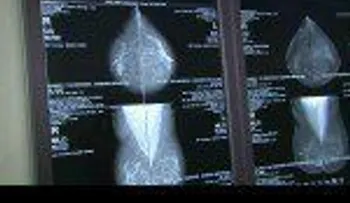 Unas 500 mil mujeres sufren de cáncer de mama en RD ¿Qué hacer para prevenirlo? (VIDEO)