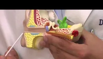 Se puso vinagre y alcohol en el oído por 60 segundos. ¡Esto es increíble! (VIDEO)