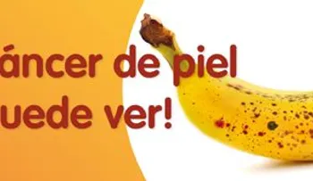 Cómo prevenir las manchas en la piel