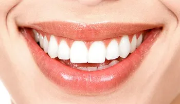 Perforaciones en la lengua pueden dañar tu boca 