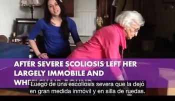 Una mujer vivió encorvada por décadas hasta que empezó a hacer yoga (VIDEO)